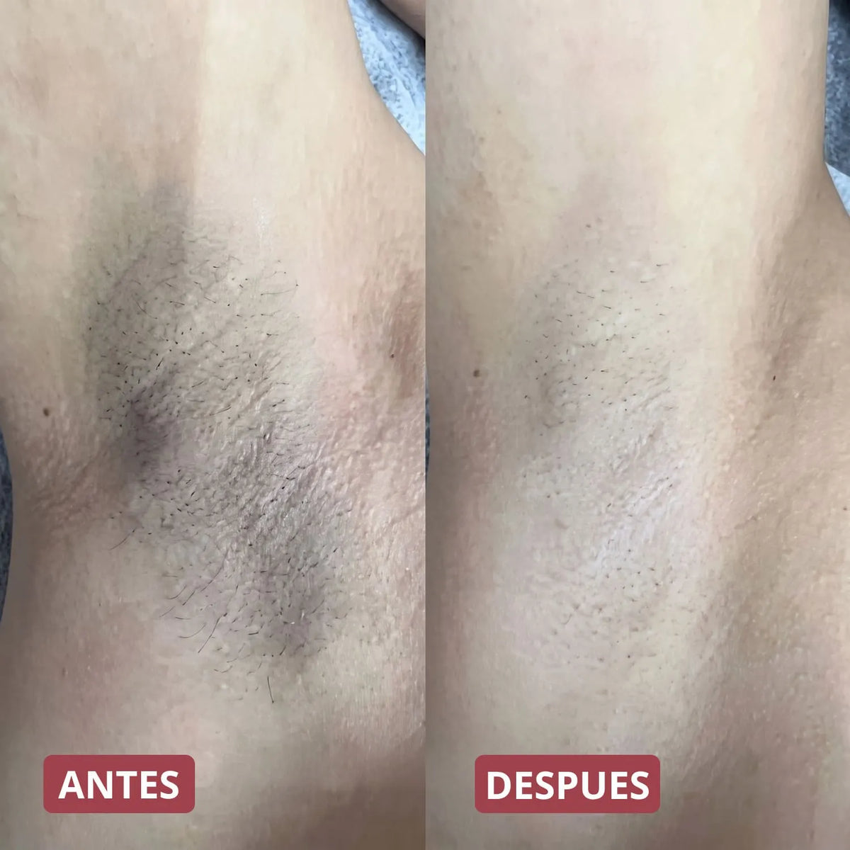 Pack Peeling Coreano Purificante para Rostro y Cuerpo
