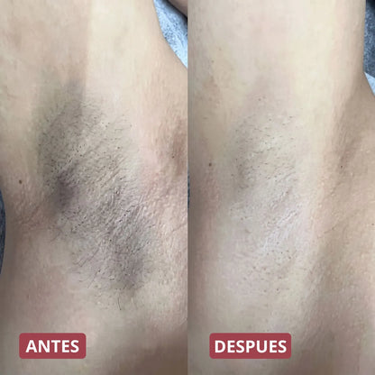 Pack Peeling Coreano Purificante para Rostro y Cuerpo