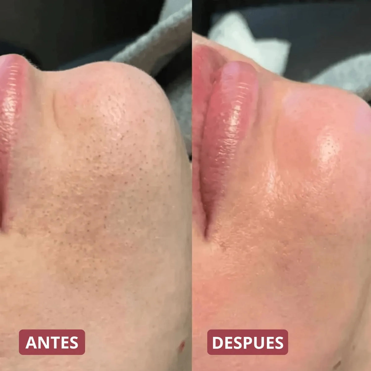 Pack Peeling Coreano Purificante para Rostro y Cuerpo