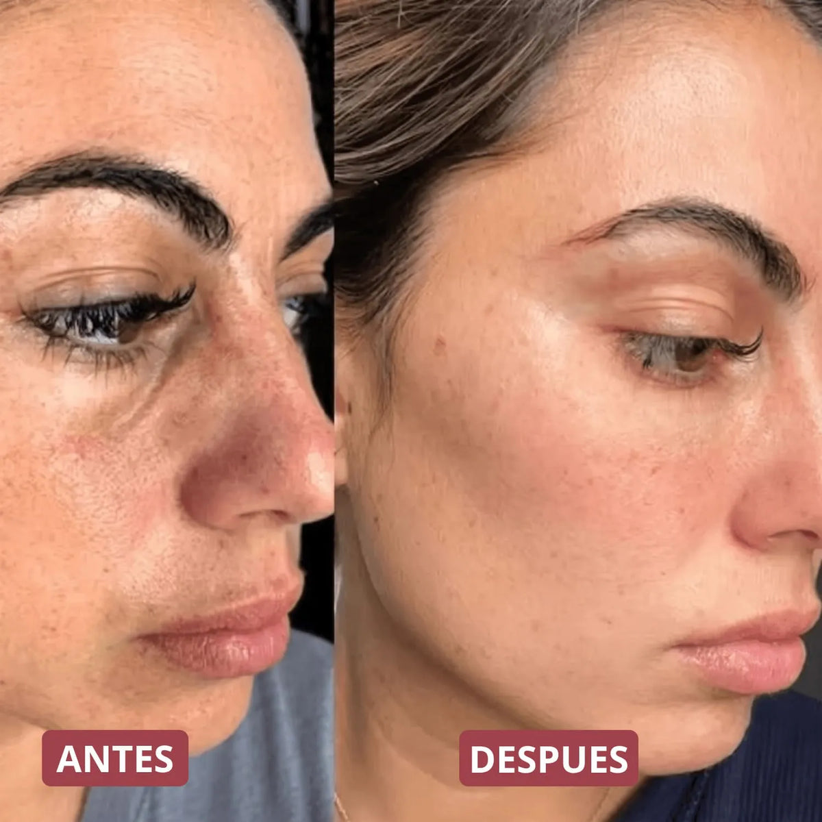 Pack Peeling Coreano Purificante para Rostro y Cuerpo