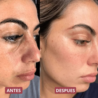 Pack Peeling Coreano Purificante para Rostro y Cuerpo