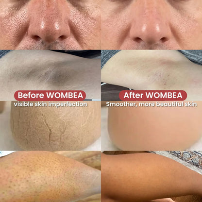 Pack Peeling Coreano Purificante para Rostro y Cuerpo
