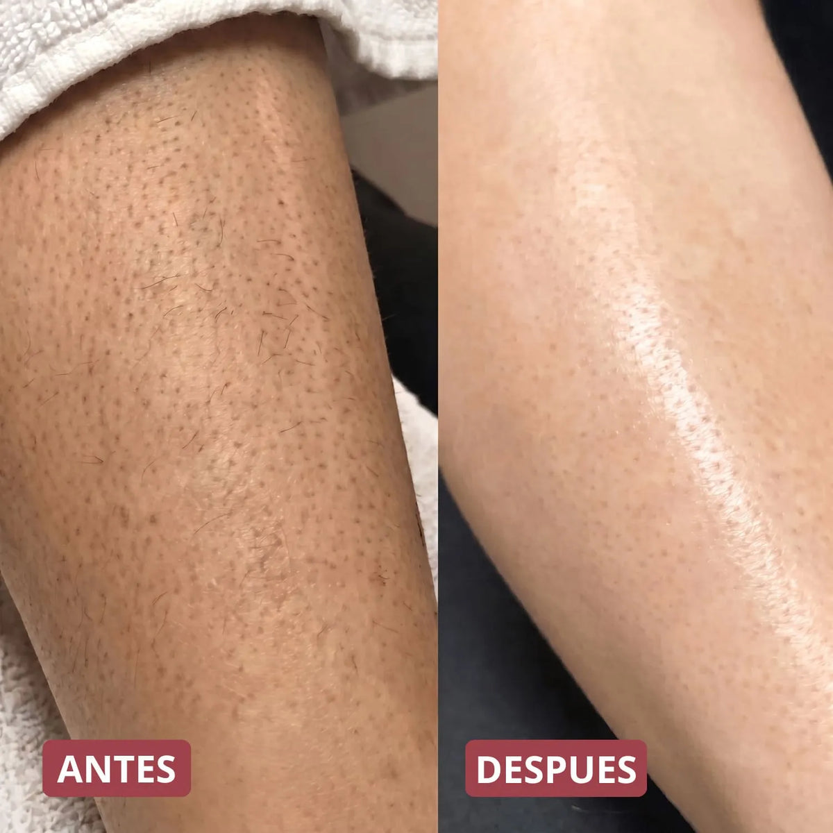 Pack Peeling Coreano Purificante para Rostro y Cuerpo