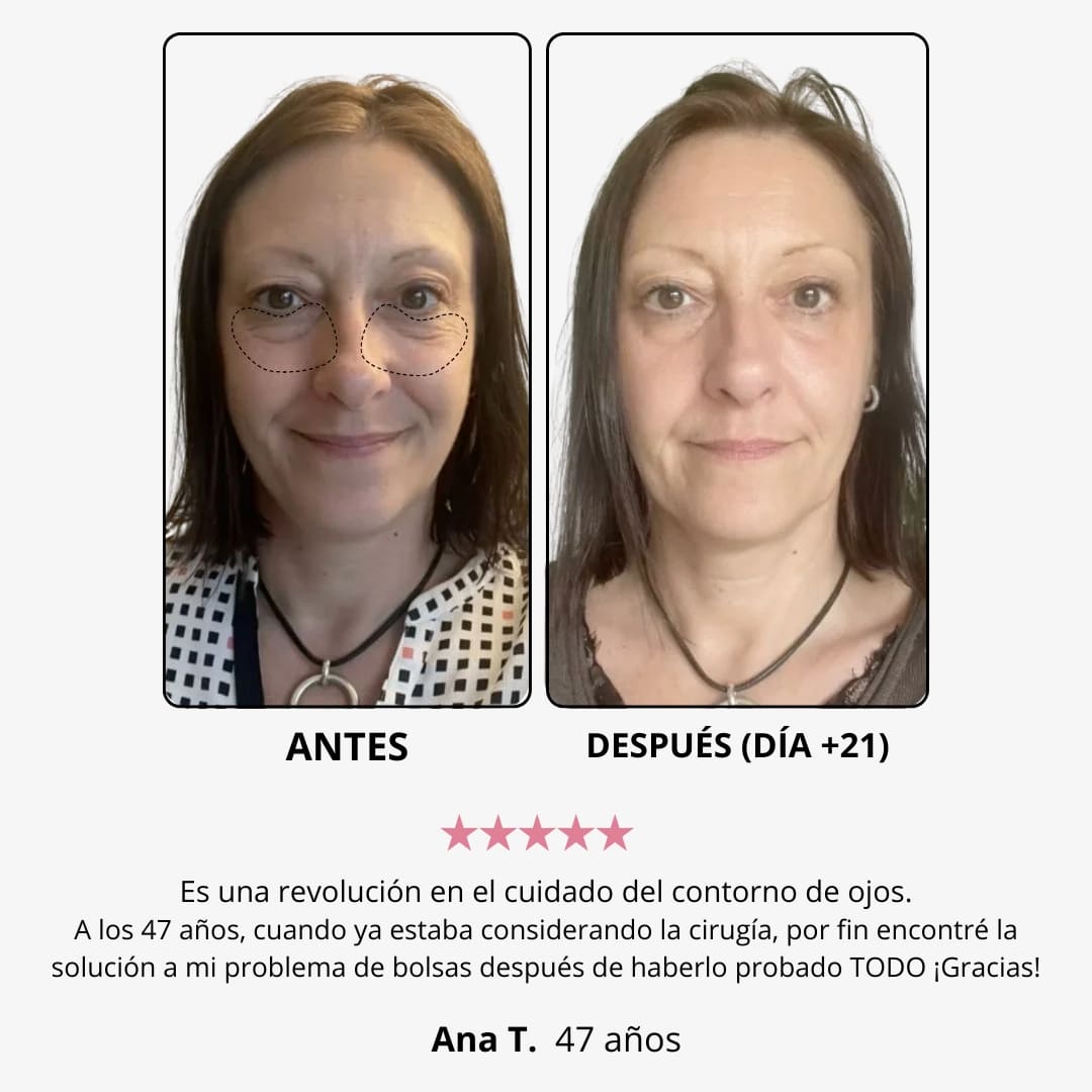 Red Light Eye Cream