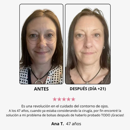 Red Light Eye Cream