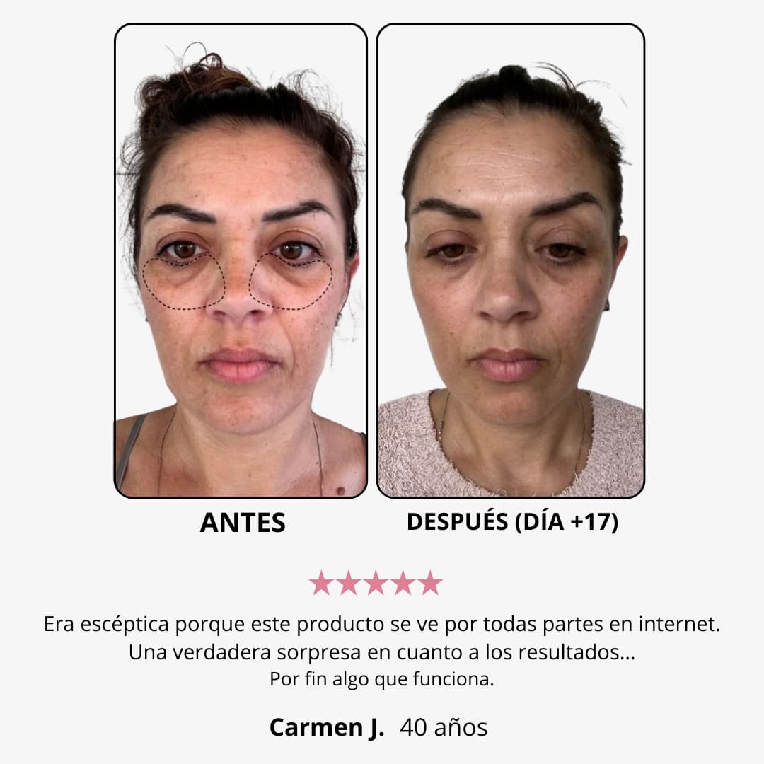 Red Light Eye Cream