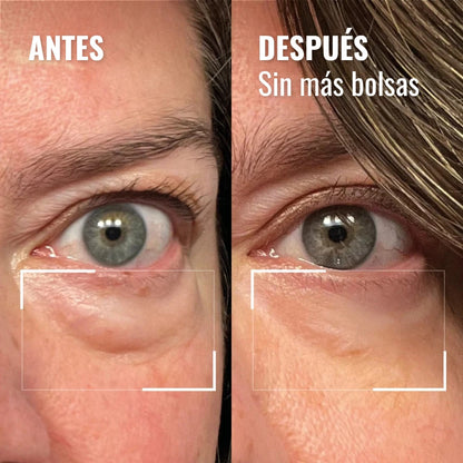 Red Light Eye Cream